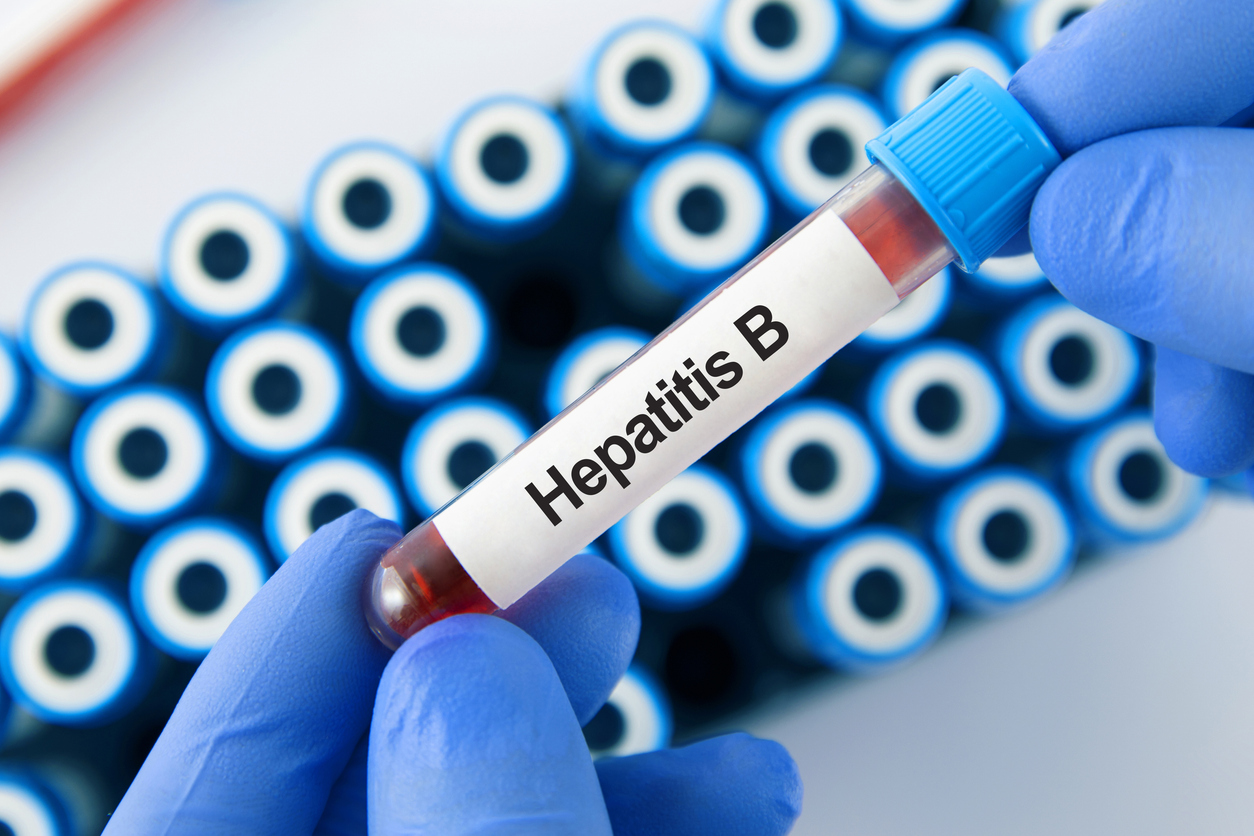 hepatitis-b