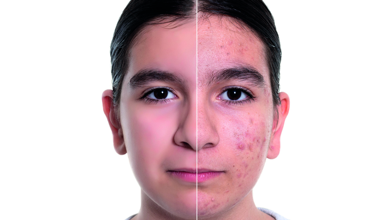 skin-main-cpd