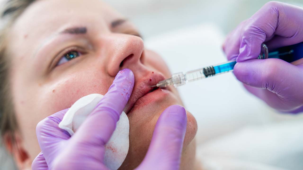 injecting fillers summary.jpg