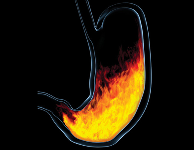 stomach_flames_heartburn_sum.jpg