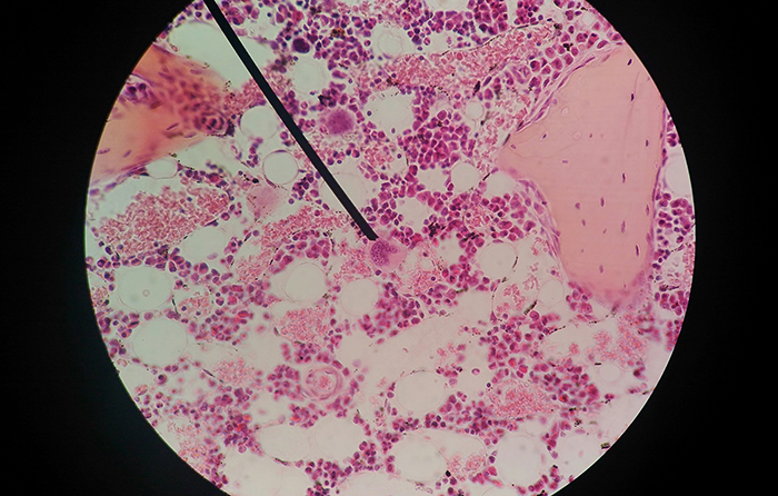 cell-cytology-examine-diagnosis-test.jpg