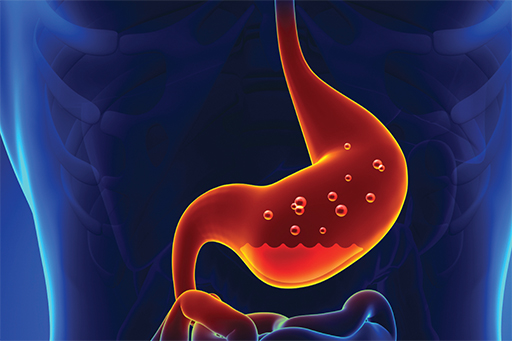 GI Gut reaction.jpg